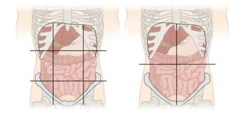 Abdominal quadrant regions